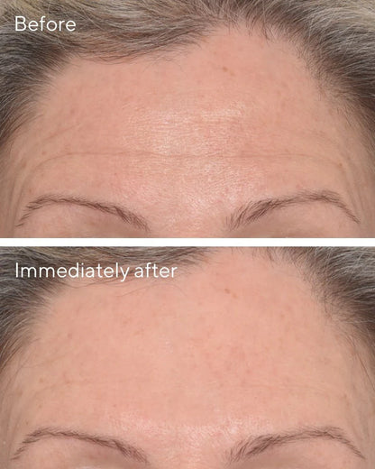 Murad - Targeted Wrinkle Corrector